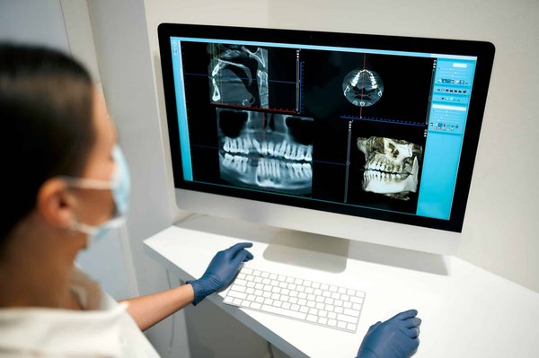 Les cliniques dentaires utilisent-elles la radiographie numérique ?